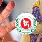 হাম উপসর্গে আরও ৫ শিশুর মৃত্যু